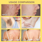 2Pcs Bee Venom Treatment, New Professional Bee Venom Repair Cream, Bee Venom Cream for All Body Parts