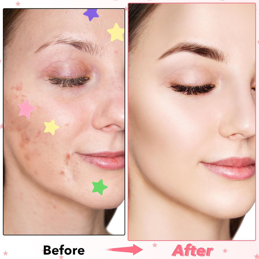 Face Pimple Patches Cute Star Zit Covers 160 Pcs Sticky Spot Stickers Hydrocolloid Pad Covering Pore Cleaning Strips Peel Invisible Spot Absorbing Zit Patch for Women Men