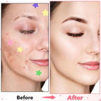 Face Pimple Patches Cute Star Zit Covers 160 Pcs Sticky Spot Stickers Hydrocolloid Pad Covering Pore Cleaning Strips Peel Invisible Spot Absorbing Zit Patch for Women Men