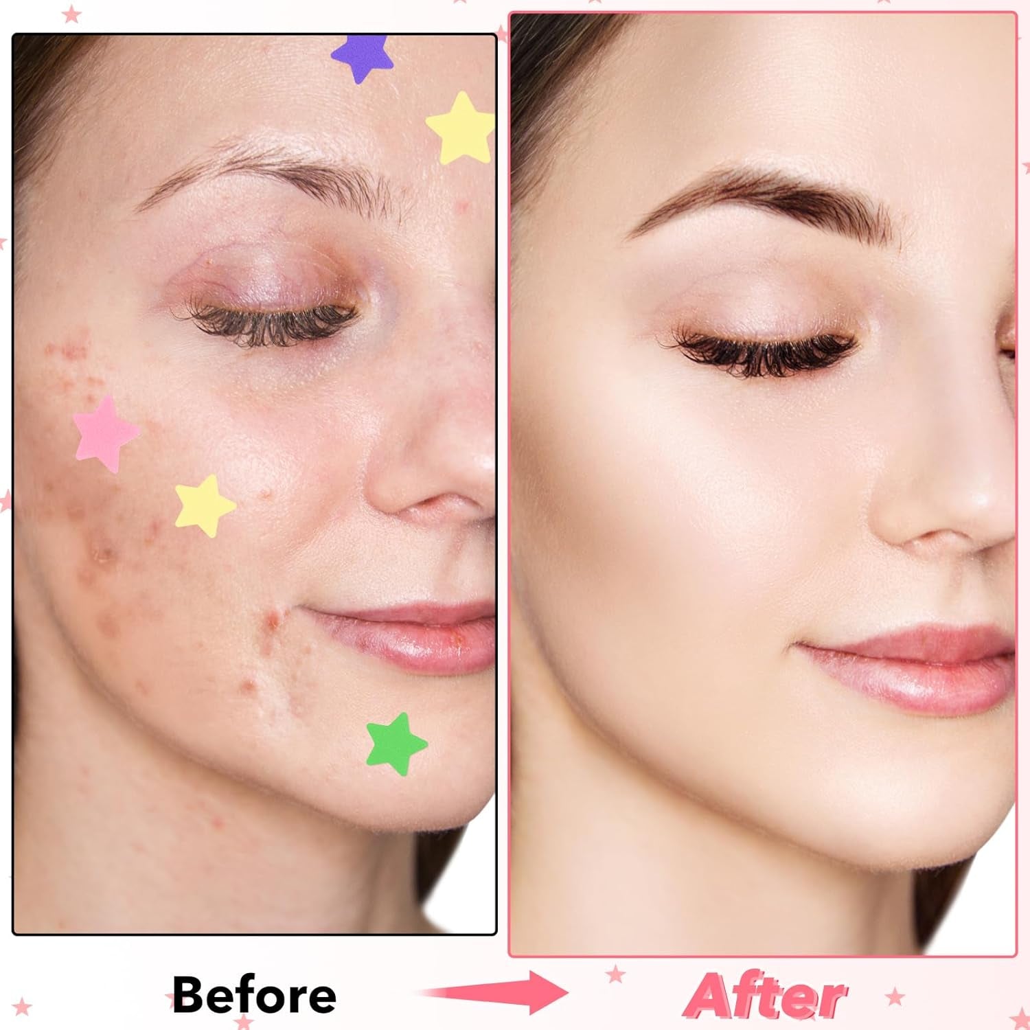 Face Pimple Patches Cute Star Zit Covers 160 Pcs Sticky Spot Stickers Hydrocolloid Pad Covering Pore Cleaning Strips Peel Invisible Spot Absorbing Zit Patch for Women Men